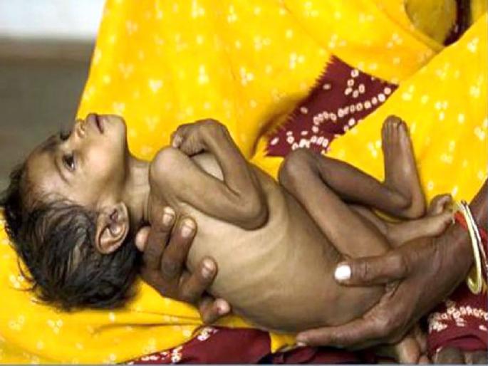 What measures are being taken to stop child deaths due to malnutrition? the HC question to the State Government | कुपोषणामुळे होणारे बालमृत्यू रोखण्यासाठी कोणते उपाय करताय? उच्च न्यायालयाची परखड विचारणा What measures are being taken to stop child deaths due to malnutrition? the HC question to the State Government | कुपोषणामुळे होणारे बालमृत्यू रोखण्यासाठी कोणते उपाय करताय? उच्च न्यायालयाची परखड विचारणा