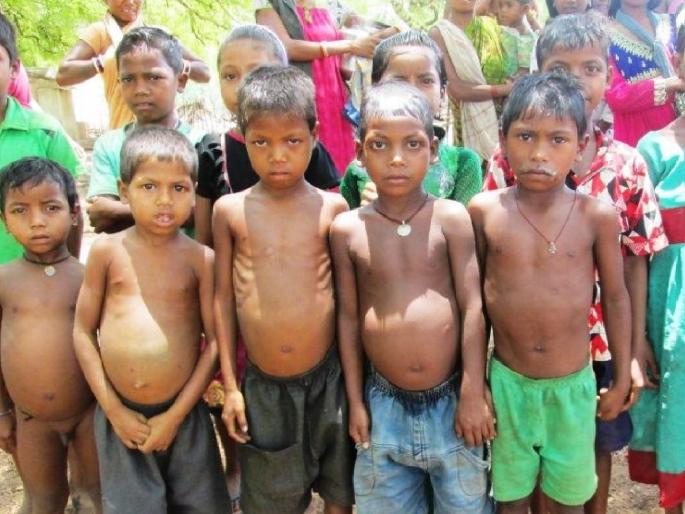 328 acutely malnourished children in Sangli district | सधन सांगली जिल्ह्यात चक्क 'इतकी' कुपोषित बालके, अडीच हजारांवर मुलांचे वजन कमी 
