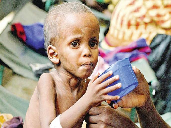 40 children in Ratnagiri district are severely malnourished | रत्नागिरी जिल्ह्यातील ४० बालके तीव्र कुपोषित, कोणत्या तालुक्यात किती.. वाचा सविस्तर 40 children in Ratnagiri district are severely malnourished | रत्नागिरी जिल्ह्यातील ४० बालके तीव्र कुपोषित, कोणत्या तालुक्यात किती.. वाचा सविस्तर