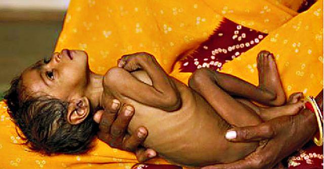 1431 children in the district became malnutrition free throughout the year | जिल्ह्यातील १४३१ बालके झाली वर्षभरात कुपोषण मुक्त