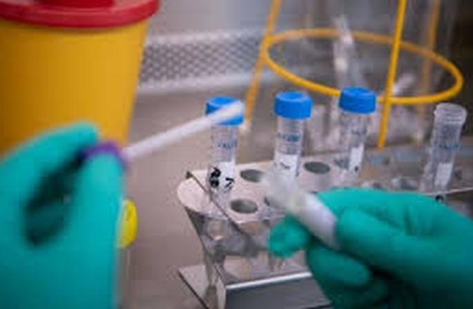 Buldana lab approval for corona testing | कोरोना चाचण्यासाठी बुलडाण्यातील प्रयोग शाळेस मान्यता Buldana lab approval for corona testing | कोरोना चाचण्यासाठी बुलडाण्यातील प्रयोग शाळेस मान्यता