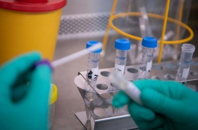 Political upheaval for the Corona Test Laboratory | कोरोना चाचणी प्रयोगशाळेसाठी राजकीय चढाओढ