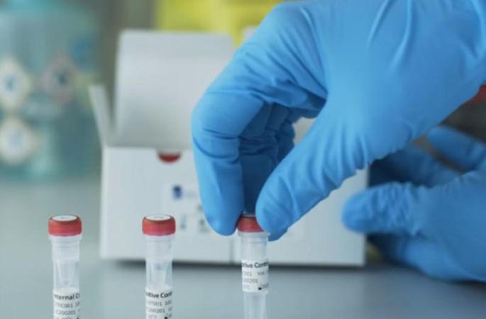 The basis of three laboratories for testing corona | ‘कोरोना’च्या चाचणीसाठी तीन प्रयोगशाळांचा आधार The basis of three laboratories for testing corona | ‘कोरोना’च्या चाचणीसाठी तीन प्रयोगशाळांचा आधार