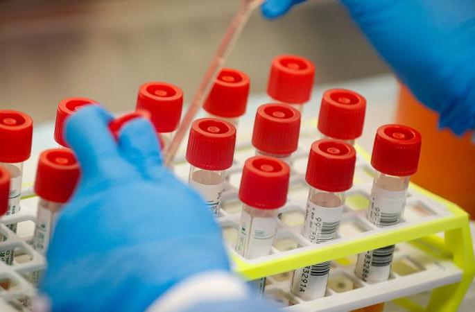 Coronavirus: Waiting for the report of that 'dead patient' | Coronavirus : त्या’ मृत रुग्णाच्या तपासणी अहवालाची प्रतीक्षा Coronavirus: Waiting for the report of that 'dead patient' | Coronavirus : त्या’ मृत रुग्णाच्या तपासणी अहवालाची प्रतीक्षा