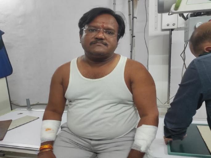ex-minister Suresh Navale's PA Lalit Abbad was attacked with a knife in Beed | बीडमध्ये माजी मंत्री सुरेश नवलेंच्या पीएवर कोयत्याने वार! ex-minister Suresh Navale's PA Lalit Abbad was attacked with a knife in Beed | बीडमध्ये माजी मंत्री सुरेश नवलेंच्या पीएवर कोयत्याने वार!