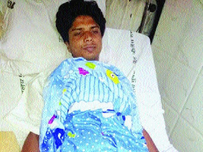 Having trouble, but the solution seems to be! Lalit Fine response after surgery | त्रास होतोय, पण समाधान वाटतेय! ललितची शस्त्रक्रियेनंतरची प्रतिक्रिया Having trouble, but the solution seems to be! Lalit Fine response after surgery | त्रास होतोय, पण समाधान वाटतेय! ललितची शस्त्रक्रियेनंतरची प्रतिक्रिया