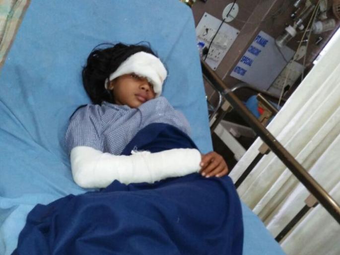 Laxmi's life filled with water shortage; Dying in the well, fighting with death! | पाणीटंचाईने होरपळले ‘लक्ष्मी’चे आयुष्य; विहिरीत पडल्याने देतेय मृत्यूशी झुंज!