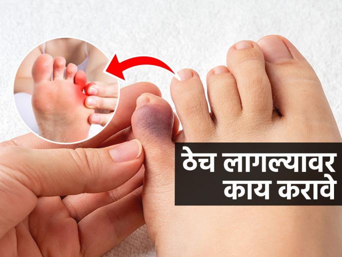 health tips, Stumbling on the little finger, brittle nails , it hurts alot, if your little finger is hurt don't ignore , home remedies | बाई माझी करंगळीला मोडली! ठेच लागून नख उडालं की प्रचंड ठणकतं, करा हे २ उपाय तातडीने