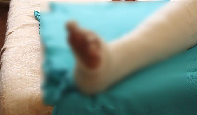 Both legs were cut in train accident | रेल्वेखाली आल्याने इसमाचे दोन्ही पाय तुटले! Both legs were cut in train accident | रेल्वेखाली आल्याने इसमाचे दोन्ही पाय तुटले!