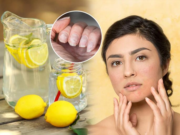 Drinking lemon water to lose weight Stop immediately if you notice these 5 symptoms – it can seriously harm your body | वजन कमी करण्यासाठी लिंबू पाणी पिताय? ५ लक्षणं दिसताच थांबा, शरीराला होऊ शकतं मोठं नुकसान