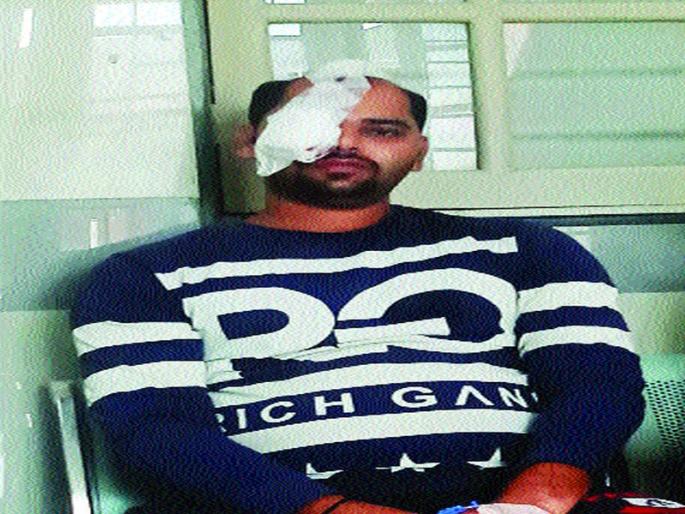 Mumbai : Leopard attacks man who tried to save pet in Mulund | मुलुंडमध्ये बिबट्याचा तरुणावर हल्ला, नागरिकांमध्ये भीतीचे वातावरण Mumbai : Leopard attacks man who tried to save pet in Mulund | मुलुंडमध्ये बिबट्याचा तरुणावर हल्ला, नागरिकांमध्ये भीतीचे वातावरण