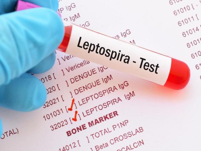 Ten people died in 20 days due to leptospirosis in Shahapur | शहापूरच्या सापगावात २० दिवसांत १० जणांचा लेप्टो स्पायरोसिसने मृत्यू Ten people died in 20 days due to leptospirosis in Shahapur | शहापूरच्या सापगावात २० दिवसांत १० जणांचा लेप्टो स्पायरोसिसने मृत्यू