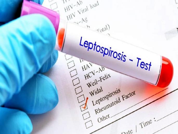 Nine leptospirosis cases reported in Wardha district | जनावरांना होणाऱ्या ‘लेप्टोस्पायरोसीस’ आजाराने मनुष्यही प्रभावित; वर्धा जिल्ह्यात ९ रुग्ण ‘पॉझिटिव्ह’ Nine leptospirosis cases reported in Wardha district | जनावरांना होणाऱ्या ‘लेप्टोस्पायरोसीस’ आजाराने मनुष्यही प्रभावित; वर्धा जिल्ह्यात ९ रुग्ण ‘पॉझिटिव्ह’
