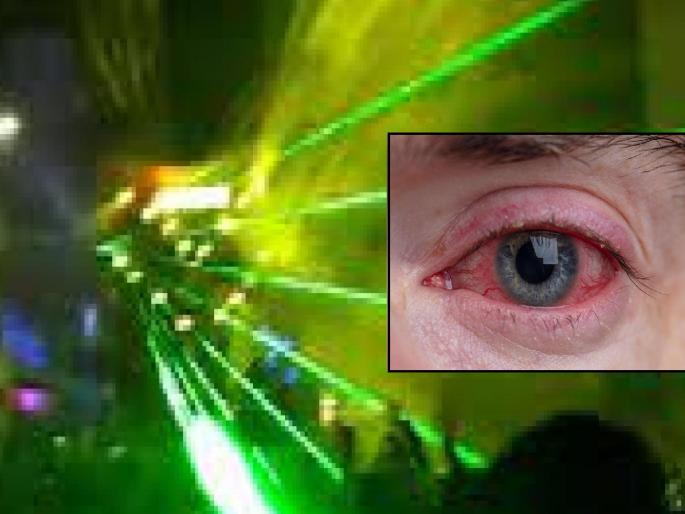 One person's eye seriously injured due to laser in procession in Ichalkaranji Kolhapur | Kolhapur: मिरवणुकीतील 'लेसर'मुळे एकाच्या डोळ्याला गंभीर इजा, इचलकरंजीतील घटना