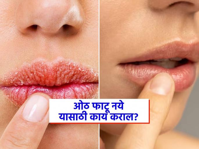 Easy tips to take care of lips in winter | थंडीत ओठांना पडणार नाही भेगा, निघणार नाही त्यावरील मास, फॉलो करा 'हे' सोपे उपाय! Easy tips to take care of lips in winter | थंडीत ओठांना पडणार नाही भेगा, निघणार नाही त्यावरील मास, फॉलो करा 'हे' सोपे उपाय!