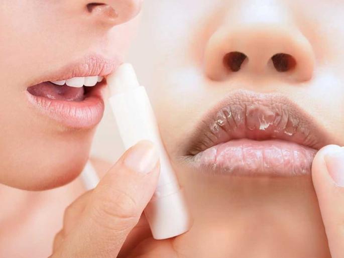 Lips will crack in the cold, but avoid these mistakes to prevent bleeding, your lips will remain soft and pink. | थंडीत ओठ फुटणारच पण रक्त येऊन जखम होऊ नये म्हणून टाळा 'या' चुका, ओठ राहतील मऊ गुलाबी Lips will crack in the cold, but avoid these mistakes to prevent bleeding, your lips will remain soft and pink. | थंडीत ओठ फुटणारच पण रक्त येऊन जखम होऊ नये म्हणून टाळा 'या' चुका, ओठ राहतील मऊ गुलाबी