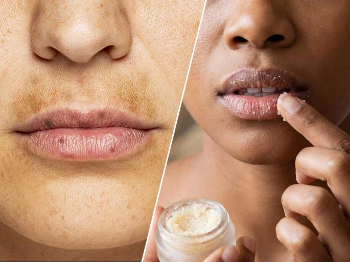 Dark skin around lips, pigmentation around mouth? try home remedies | ओठांजवळची त्वचा निस्तेज आणि काळवंडलेली दिसते? मिळवा सुंदर त्वचा आणि दुखण्यापासून आराम Dark skin around lips, pigmentation around mouth? try home remedies | ओठांजवळची त्वचा निस्तेज आणि काळवंडलेली दिसते? मिळवा सुंदर त्वचा आणि दुखण्यापासून आराम