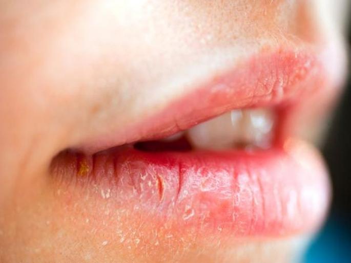How to remove darkness of the lips by using home remedies myb | सुट्टीचा फायदा करून सौंदर्य खुलवा,ओठांचा काळपटपणा 'या' सोप्या पद्धतीने घालवा How to remove darkness of the lips by using home remedies myb | सुट्टीचा फायदा करून सौंदर्य खुलवा,ओठांचा काळपटपणा 'या' सोप्या पद्धतीने घालवा