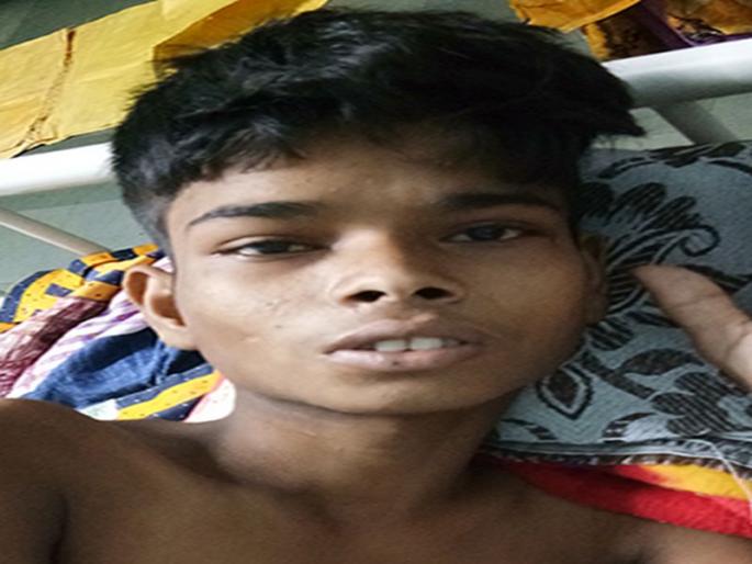 Lived at the Jalgaon District Hospital | अत्यवस्थ तरुणाला जळगाव जिल्हा रुग्णालयात जीवदान Lived at the Jalgaon District Hospital | अत्यवस्थ तरुणाला जळगाव जिल्हा रुग्णालयात जीवदान