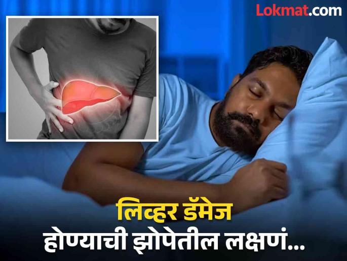 Liver Damage Warning signs visible during sleeping people often ignore these symptoms | रात्री झोपताना दिसतात लिव्हर खराब होण्याचे 'हे' संकेत, 90 टक्के लोक याकडे करतात दुर्लक्ष! Liver Damage Warning signs visible during sleeping people often ignore these symptoms | रात्री झोपताना दिसतात लिव्हर खराब होण्याचे 'हे' संकेत, 90 टक्के लोक याकडे करतात दुर्लक्ष!