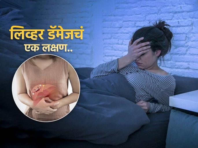 Hidden sign of liver damage that you can see at night | लिव्हर डॅमेज होत असल्याचं एक लक्षण रात्री दिसू शकतं, ‘असं’ होत असेल तर डॉक्टरांकडे जा तातडीने!