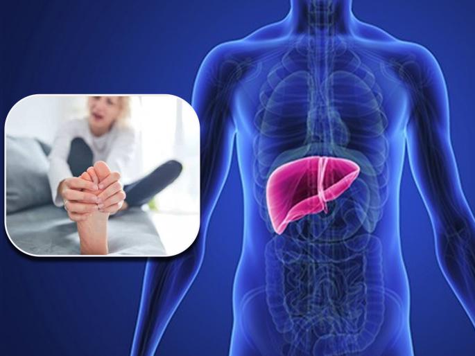 Liver disease signs and symptoms in your feet causes signals and problems | तळपायांमध्ये होत असेल ही समस्या तर समजून घ्या डॅमेज होत आहे तुमचं लिव्हर Liver disease signs and symptoms in your feet causes signals and problems | तळपायांमध्ये होत असेल ही समस्या तर समजून घ्या डॅमेज होत आहे तुमचं लिव्हर