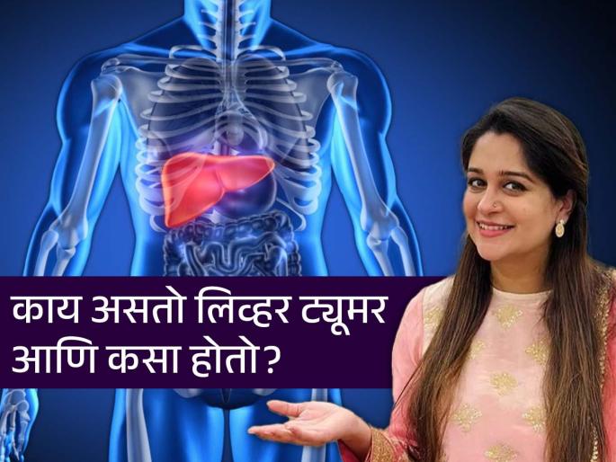 Dipika Kakar diagnosed with liver tumour, know whats is this disease and its symptoms | अभिनेत्री दीपिका कक्करच्या लिव्हरमध्ये ट्यूमर, वाचा काय असतो हा ट्यूमर आणि कशामुळे होतो?