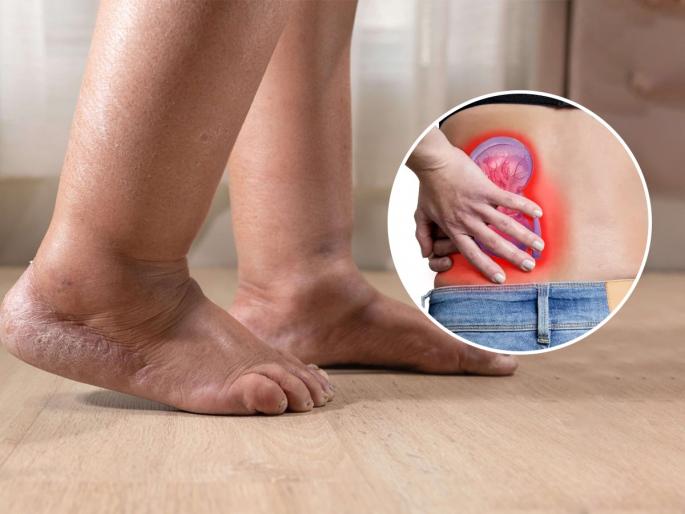 Constant swelling and itching on the legs Signs of liver disease Liver failure symptoms | पायांवर सतत सूज-खाजही सुटते? हे तर लिव्हरच्या गंभीर आजाराचे लक्षण, जीवाला धोका आहे..