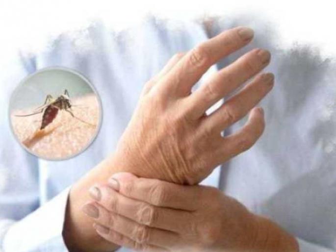 Chikungunya wreaks havoc in Amravati district; 282 patients in nine months | अमरावती जिल्ह्यात चिकुनगुनियाचा कहर ; नऊ महिन्यांत २८२ रुग्ण Chikungunya wreaks havoc in Amravati district; 282 patients in nine months | अमरावती जिल्ह्यात चिकुनगुनियाचा कहर ; नऊ महिन्यांत २८२ रुग्ण