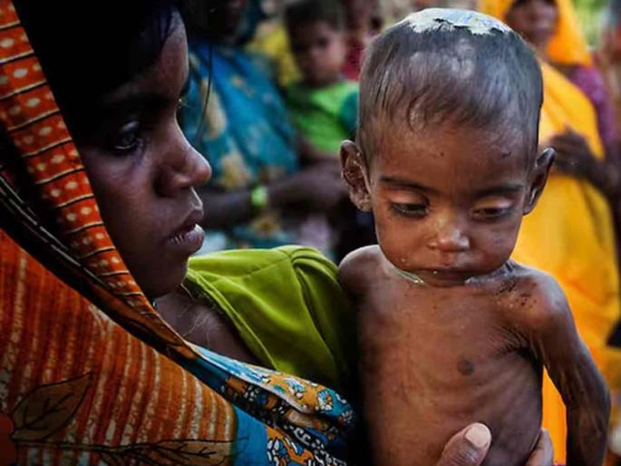 1064 children died in Melghat in five and a half years | मेळघाटात साडेपाच वर्षांत १०६४ बालकांनी दम तोडला 1064 children died in Melghat in five and a half years | मेळघाटात साडेपाच वर्षांत १०६४ बालकांनी दम तोडला