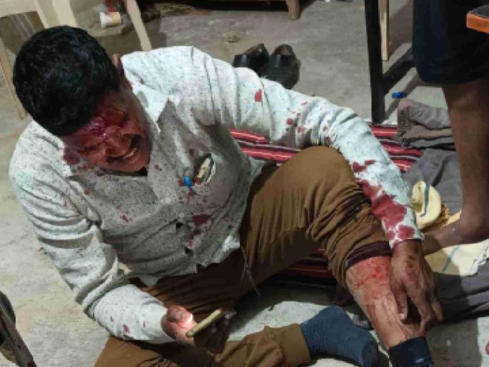 Sand smugglers attack Talathi in Vaddona | वाढोणा येथील तलाठ्यावर रेती तस्करांचा हल्ला Sand smugglers attack Talathi in Vaddona | वाढोणा येथील तलाठ्यावर रेती तस्करांचा हल्ला