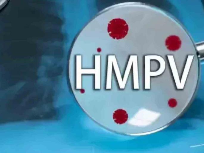 Two patients of 'HMPV' in Nagpur! A 17-year-old girl and a 7-year-old boy infected | नागपुरात ‘एचएमपीव्ही’चे ते दोन रुग्ण संशयित Two patients of 'HMPV' in Nagpur! A 17-year-old girl and a 7-year-old boy infected | नागपुरात ‘एचएमपीव्ही’चे ते दोन रुग्ण संशयित