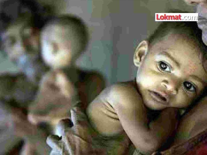 834 children in the district are underweight under the shade of malnutrition | जिल्ह्यातील ८३४ बालके कमी वजनाने कुपोषणाच्या छायेत 834 children in the district are underweight under the shade of malnutrition | जिल्ह्यातील ८३४ बालके कमी वजनाने कुपोषणाच्या छायेत
