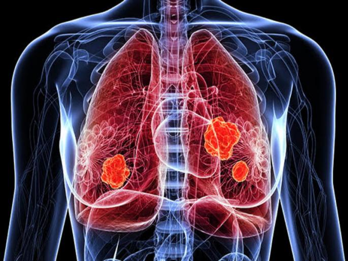 Staying beside smokers also causes cancer Expert opinion doctors say avoid smoking | स्मोकर्सच्या बाजूला थांबल्यानेही होतो कर्करोग; तज्ज्ञांचे मत, डॅाक्टर म्हणतात धूम्रपान टाळा Staying beside smokers also causes cancer Expert opinion doctors say avoid smoking | स्मोकर्सच्या बाजूला थांबल्यानेही होतो कर्करोग; तज्ज्ञांचे मत, डॅाक्टर म्हणतात धूम्रपान टाळा