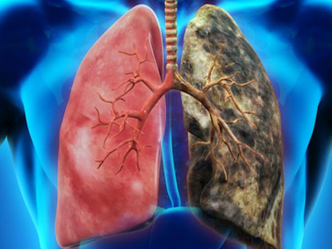 Google new AI to detect lung cancer faster and better than doctors | फुप्फुसाच्या कॅन्सरची माहिती लवकर मिळवण्यात डॉक्टरांना मात देणार गुगलचा एआय! Google new AI to detect lung cancer faster and better than doctors | फुप्फुसाच्या कॅन्सरची माहिती लवकर मिळवण्यात डॉक्टरांना मात देणार गुगलचा एआय!