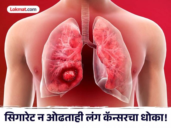 Lung cancer cases in never smokers on the rise says lancet study | सिगारेट न ओढणाऱ्यांमध्येही वेगानं वाढत आहे लंग कॅन्सरच्या केसेस, वैज्ञानिक चिंतेत!