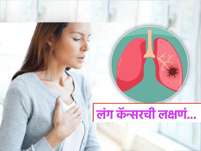 World Lung Cancer Day 2025 : Lung cancer causes and symptoms | World Lung Cancer Day 2025 : फुप्फुसाच्या कॅन्सरची 'ही' लक्षणं वेळीच ओळखा, बरेच दिवस सतत खोकला ठरु शकतो जीवघेणा