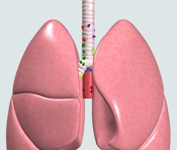 Nagpur second in the state of lung cancer | फुफ्फुसाच्या कॅन्सरमध्ये राज्यात नागपूर दुसरे Nagpur second in the state of lung cancer | फुफ्फुसाच्या कॅन्सरमध्ये राज्यात नागपूर दुसरे