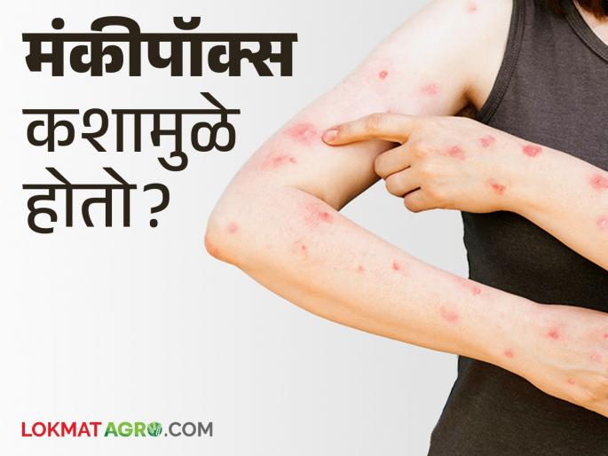 Monkey Pox : Monkeypox is a disease transmitted from animals to humans; what are the symptoms? How to take care of it? | Monkey Pox : प्राण्यांपासून माणसांत संसर्ग होणारा आजार मंकीपॉक्स; काय आहेत लक्षणे? कशी घ्याल काळजी?