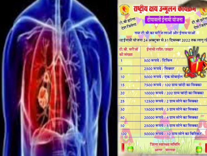 Madhya Pradesh's Agar Malwa district, the health department has made a unique offer to sensitize TB patients | टीबीच्या रुग्णाला आणा मिळवा सोन्याच्या नाण्यांसह रोख बक्षीस, रूग्णालयाची अनोखी ऑफर Madhya Pradesh's Agar Malwa district, the health department has made a unique offer to sensitize TB patients | टीबीच्या रुग्णाला आणा मिळवा सोन्याच्या नाण्यांसह रोख बक्षीस, रूग्णालयाची अनोखी ऑफर