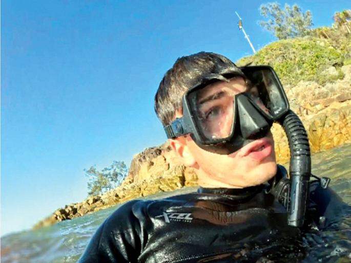 The shark ate Matteo's right leg! | शार्कने खाल्ला माट्टेओचा उजवा पाय ! The shark ate Matteo's right leg! | शार्कने खाल्ला माट्टेओचा उजवा पाय !