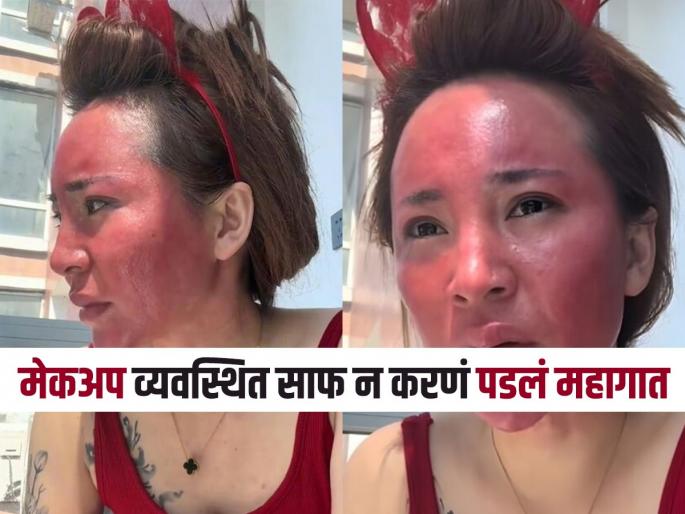 Women did not wash her face after applying makeup now skin got spoiled | मेकअप करायची पण चेहराच धुत नव्हती तरुणी, एके दिवशी काय झाले...