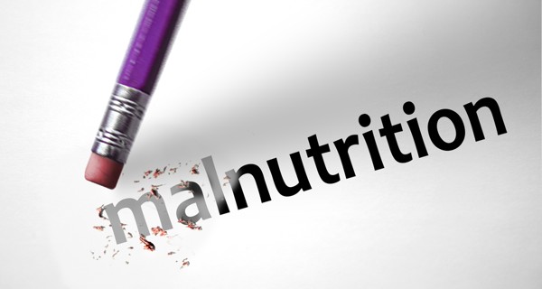 100 malnourished children in Akola district | कुपोषणाचे दुष्टचक्र, अकोला जिल्ह्यात शंभरावर बालके कुपोषित 100 malnourished children in Akola district | कुपोषणाचे दुष्टचक्र, अकोला जिल्ह्यात शंभरावर बालके कुपोषित