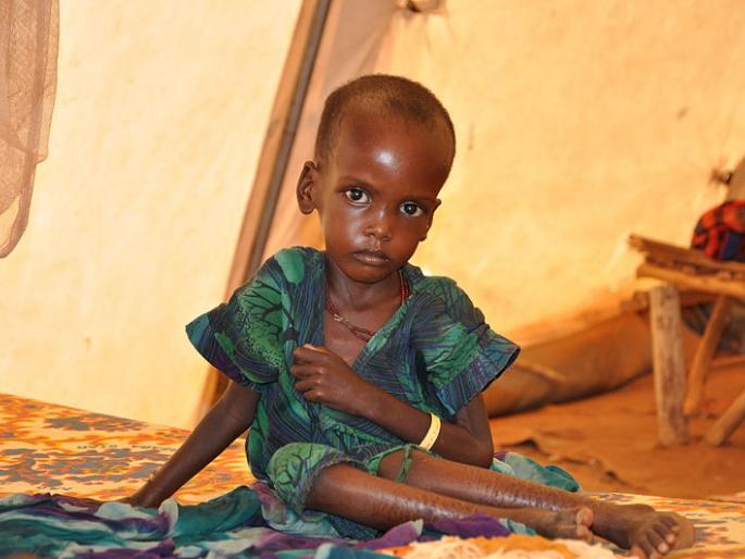 For the last 30 years, children are dying due to malnutrition, who will cry for them?.. threatening reality of malnutrition, in Nandurbar.. | इथं गेली 30 वर्षं मुलं मरतात, त्यांच्यासाठी कोण रडणार?..