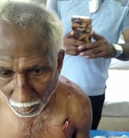 Tiger attack on elderly cowherd | वयोवृद्ध गुराख्यावर वाघाचा हल्ला; जखमी अवस्थेत कुऱ्हाडीने पिटाळून लावले Tiger attack on elderly cowherd | वयोवृद्ध गुराख्यावर वाघाचा हल्ला; जखमी अवस्थेत कुऱ्हाडीने पिटाळून लावले