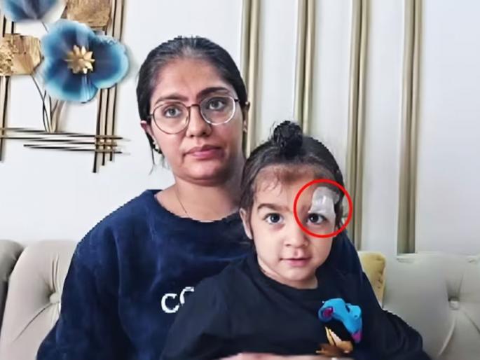 meerut doctor instead of injury stitching pasted fevikwik | हलगर्जीपणाचा कळस! डॉक्टरने अडीच वर्षीय मुलाच्या डोळ्याजवळील जखमेवर लावलं फेविक्विक