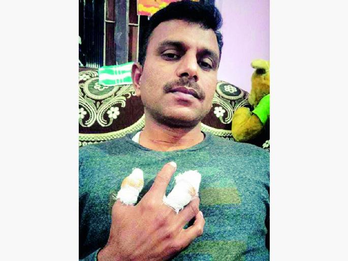 man on bike seriously injured after his neck gets caught in manja thread | मांजामुळे प्राध्यापकाचा आला होता काळ.. थोडक्यात बचावला man on bike seriously injured after his neck gets caught in manja thread | मांजामुळे प्राध्यापकाचा आला होता काळ.. थोडक्यात बचावला