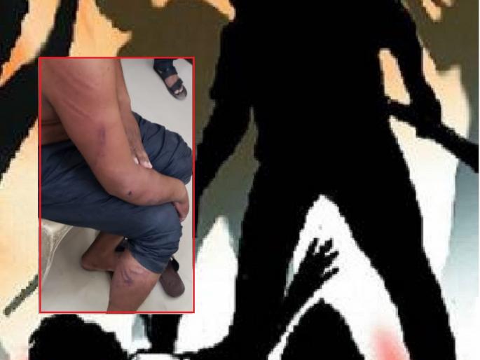 Anger over Deputy Chief Minister Devendra Fadnavis' status on social media; two men beat up the young man | उपमुख्यमंत्री फडणविसांचे स्टेटस ठेवल्याचा राग; दोघांनी तरुणाला केली बेदम मारहाण Anger over Deputy Chief Minister Devendra Fadnavis' status on social media; two men beat up the young man | उपमुख्यमंत्री फडणविसांचे स्टेटस ठेवल्याचा राग; दोघांनी तरुणाला केली बेदम मारहाण