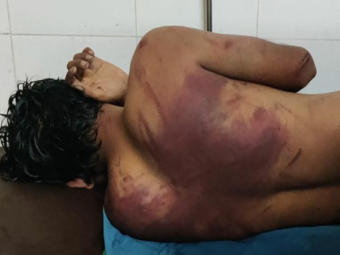 Minor boy kidnapped and brutally beaten Massajog repeats in Phaltan taluka of Satara district | मस्साजोगची पुनरावृत्ती; फलटणमध्ये अल्पवयीन मुलाचे अपहरण करुन पाठीवर वळ उठेपर्यंत मारहाण Minor boy kidnapped and brutally beaten Massajog repeats in Phaltan taluka of Satara district | मस्साजोगची पुनरावृत्ती; फलटणमध्ये अल्पवयीन मुलाचे अपहरण करुन पाठीवर वळ उठेपर्यंत मारहाण