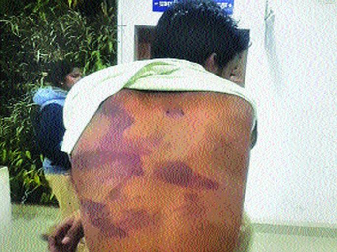 Six people were arrested in the name of addiction, minor boy, unconscious | व्यसनमुक्तीच्या नावाखाली अमानुष मारहाण, अल्पवयीन मुलगा पडला बेशुद्ध, सहा जणांना अटक Six people were arrested in the name of addiction, minor boy, unconscious | व्यसनमुक्तीच्या नावाखाली अमानुष मारहाण, अल्पवयीन मुलगा पडला बेशुद्ध, सहा जणांना अटक